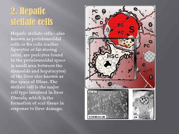 2. Hepatic stellate cells - also known as perisinusoidal cells or Ito cells (earlier