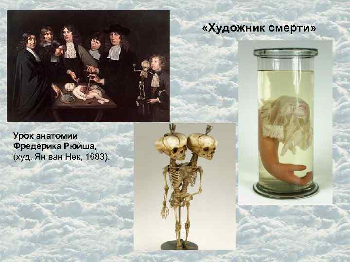  «Художник смерти» Урок анатомии Фредерика Рюйша, (худ. Ян ван Нек, 1683). 