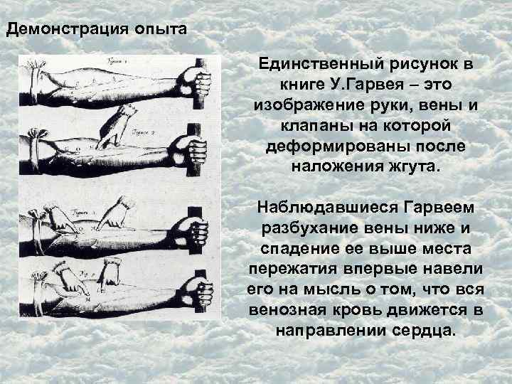 Демонстрация опыта Единственный рисунок в книге У. Гарвея – это изображение руки, вены и