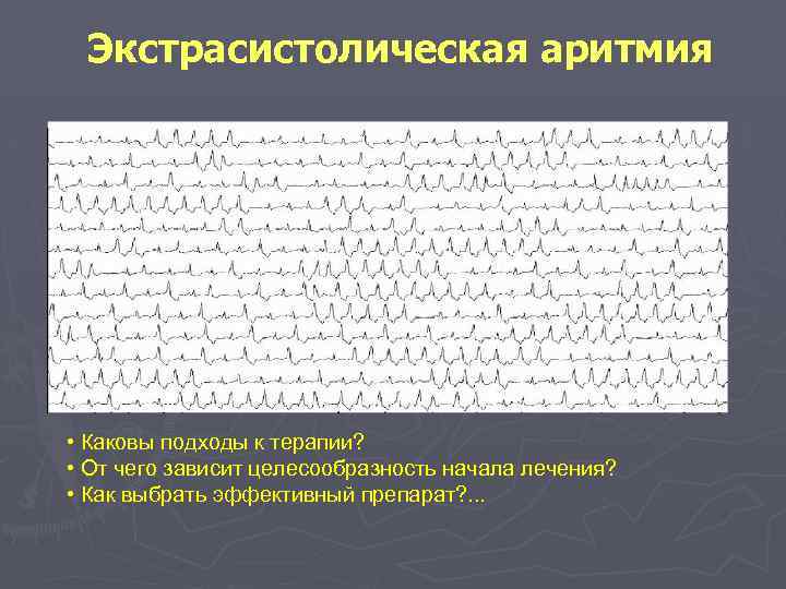 Экстрасистолическая аритмия • Каковы подходы к терапии? • От чего зависит целесообразность начала лечения?