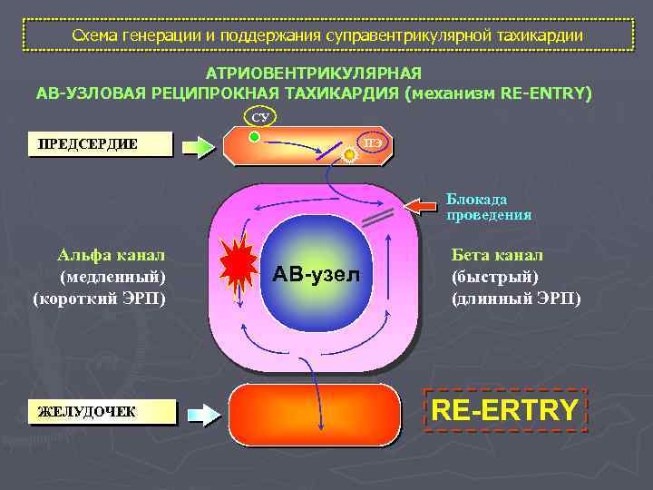 Схема генерации и поддержания суправентрикулярной тахикардии АТРИОВЕНТРИКУЛЯРНАЯ АВ-УЗЛОВАЯ РЕЦИПРОКНАЯ ТАХИКАРДИЯ (механизм RE-ENTRY) СУ ПЭ