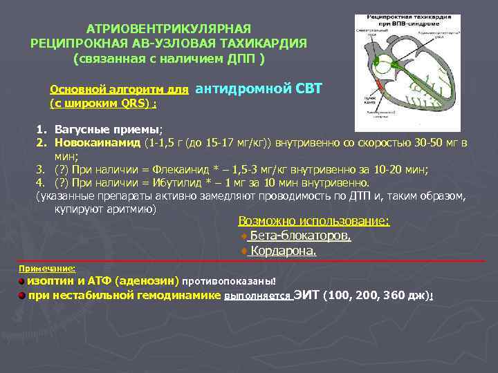 АТРИОВЕНТРИКУЛЯРНАЯ РЕЦИПРОКНАЯ АВ-УЗЛОВАЯ ТАХИКАРДИЯ (связанная с наличием ДПП ) Основной алгоритм для (с широким