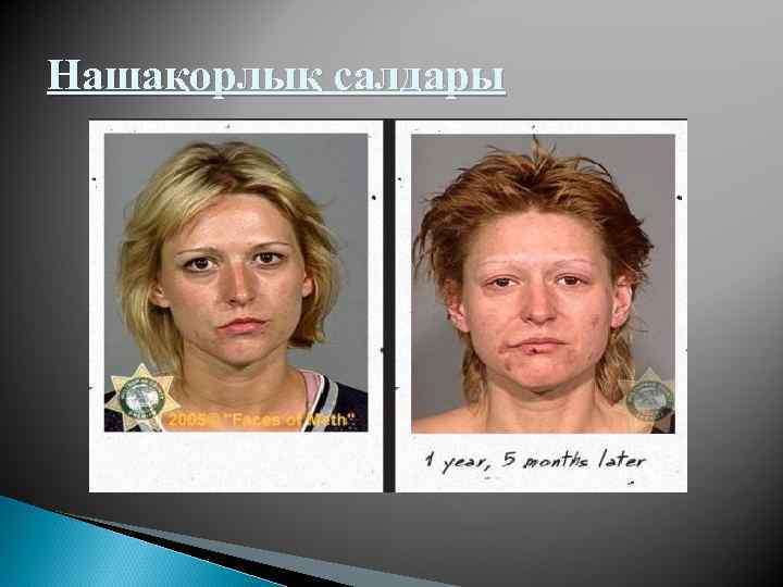 Нашақорлық салдары 