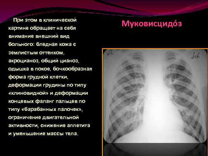 При этом в клинической картине обращает на себя внимание внешний вид больного: бледная кожа