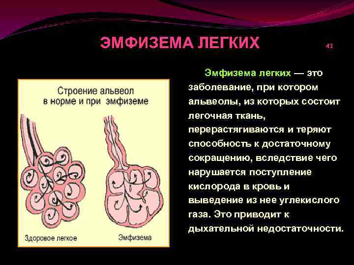 Эмфизема легких что это такое. Обструктивная эмфизема. Эмфизема легких патофизиология.