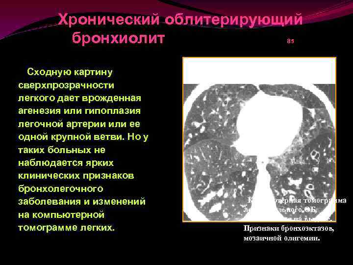 Заболеваниями сходными по клинической картине с гипоплазией эмали являются