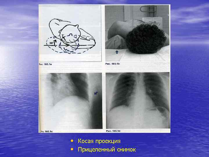  • Косая проекция • Прицеленный снимок 