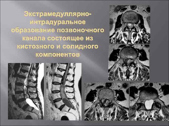 Дуги позвоночника образуют