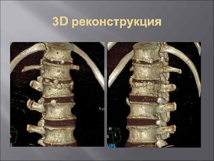 3 D реконструкция 