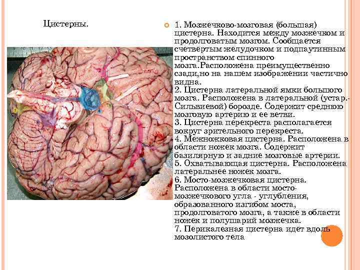 Цистерны. 1. Мозжечково-мозговая (большая) цистерна. Находится между мозжечком и продолговатым мозгом. Сообщается счетвертым желудочком