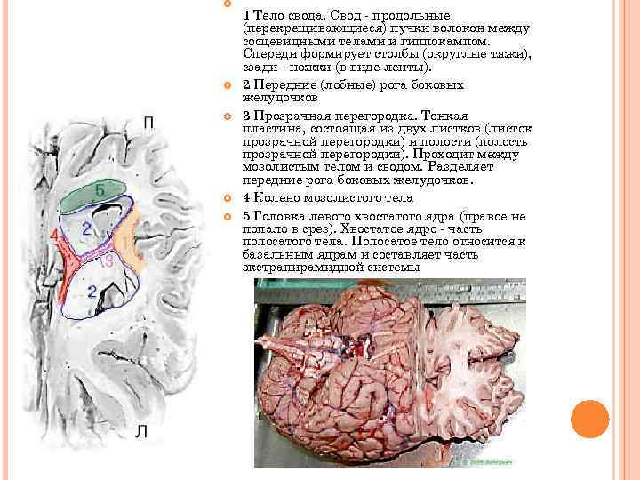  1 Тело свода. Свод - продольные (перекрещивающиеся) пучки волокон между сосцевидными телами и
