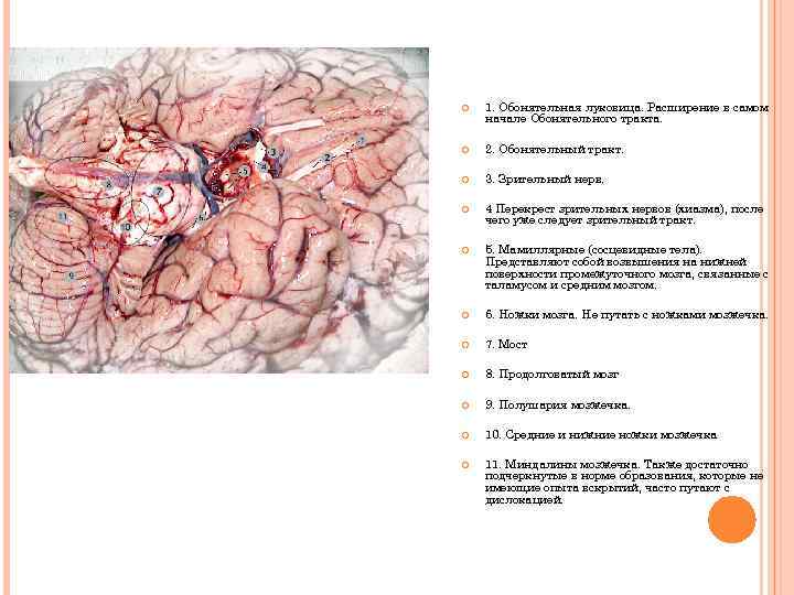  1. Обонятельная луковица. Расширение в самом начале Обонятельного тракта. 2. Обонятельный тракт. 3.