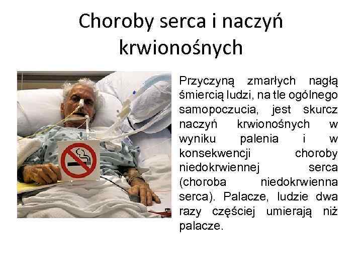 Choroby serca i naczyń krwionośnych Przyczyną zmarłych nagłą śmiercią ludzi, na tle ogólnego samopoczucia,