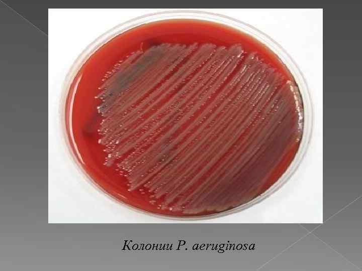 Колонии P. aeruginosa 