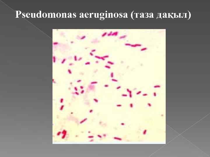 Pseudomonas aeruginosa (таза дақыл) 