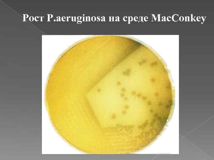 Рост P. aeruginosa на среде Mac. Conkey 