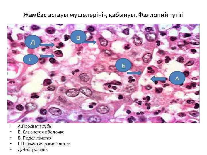 Жамбас астауы мүшелерінің қабынуы. Фаллопий түтігі • • • А. Просвет трубы Б. Слизистая