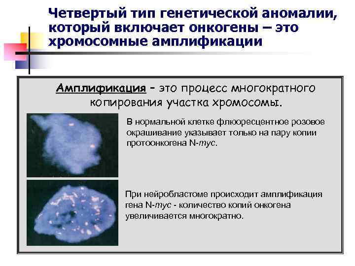 Четвертый тип генетической аномалии, который включает онкогены – это хромосомные амплификации Амплификация – это