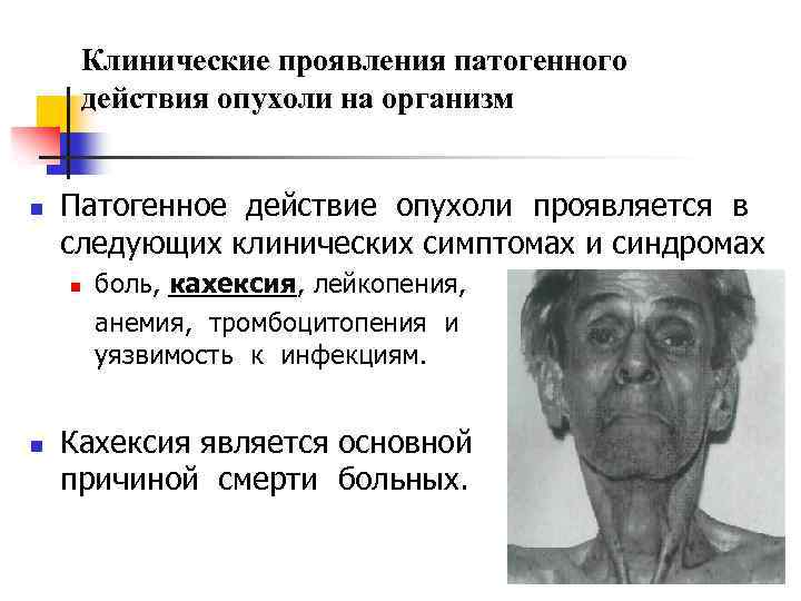 Клинические проявления патогенного действия опухоли на организм n Патогенное действие опухоли проявляется в следующих