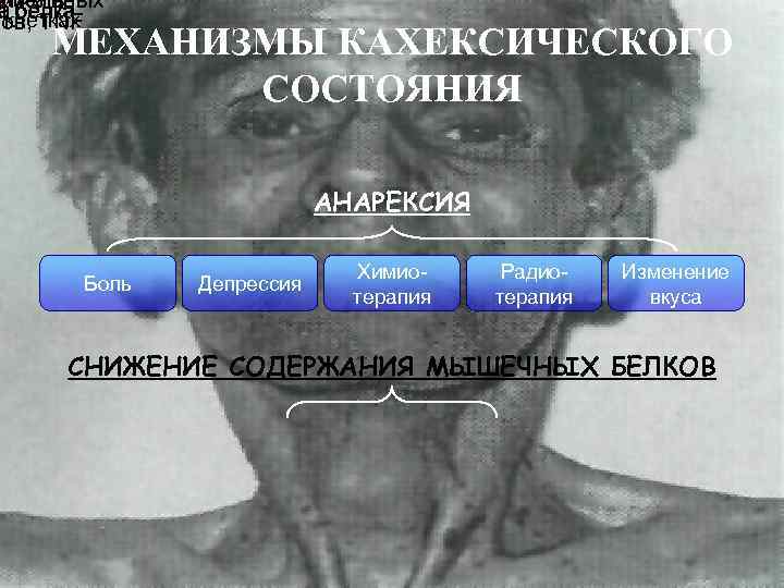 олиза в лительных а белка аклетках нов, TNF МЕХАНИЗМЫ КАХЕКСИЧЕСКОГО СОСТОЯНИЯ АНАРЕКСИЯ Боль Депрессия