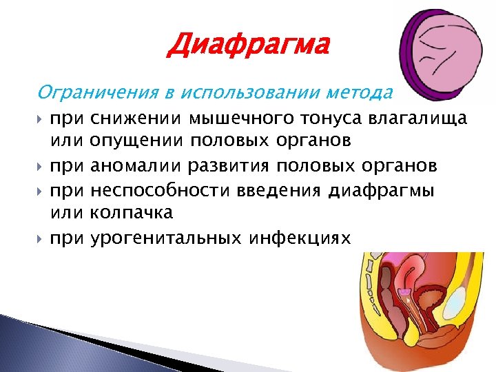 Диафрагма Ограничения в использовании метода при снижении мышечного тонуса влагалища или опущении половых органов
