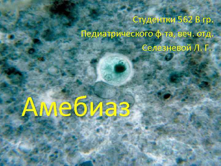 Студентки 562 В гр. Педиатрического ф-та, веч. отд. Селезневой Л. Г. Амебиаз 