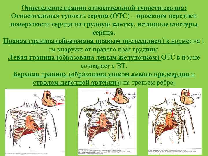 Определение границ относительной тупости сердца: Относительная тупость сердца (ОТС) – проекция передней поверхности сердца