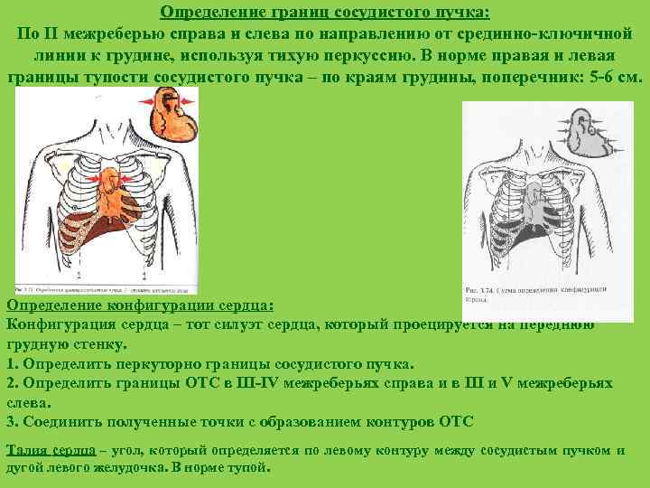 Сосудистый пучок