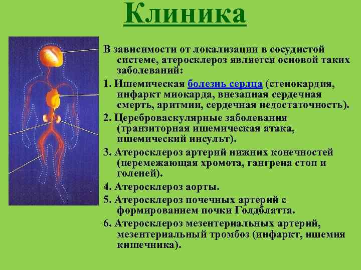 Клиника В зависимости от локализации в сосудистой системе, атеросклероз является основой таких заболеваний: 1.