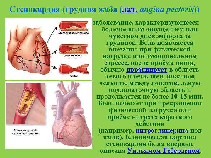 Стенокардия (грудная жаба (лат. angina pectoris)) заболевание, характеризующееся болезненным ощущением или чувством дискомфорта за