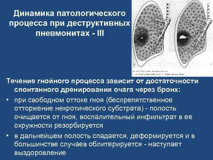 Динамика патологического процесса при деструктивных пневмонитах - III Течение гнойного процесса зависит от достаточности