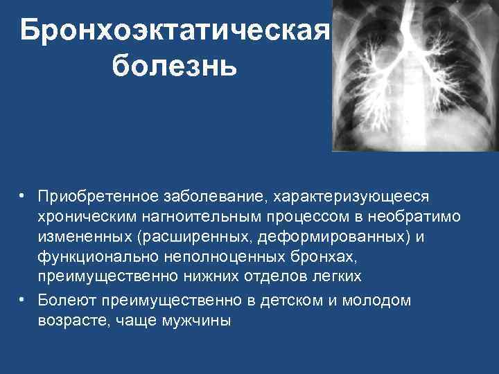 Бронхоэктатическая болезнь • Приобретенное заболевание, характеризующееся хроническим нагноительным процессом в необратимо измененных (расширенных, деформированных)