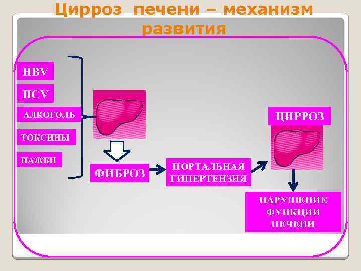 Цирроз печени – механизм развития HBV HCV ЦИРРОЗ АЛКОГОЛЬ ТОКСИНЫ НАЖБП ФИБРОЗ ПОРТАЛЬНАЯ ГИПЕРТЕНЗИЯ