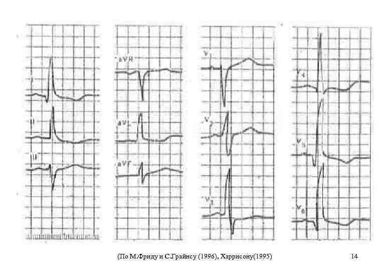 (По М. Фриду и С. Грайнсу (1996), Харрисону(1995) 14 
