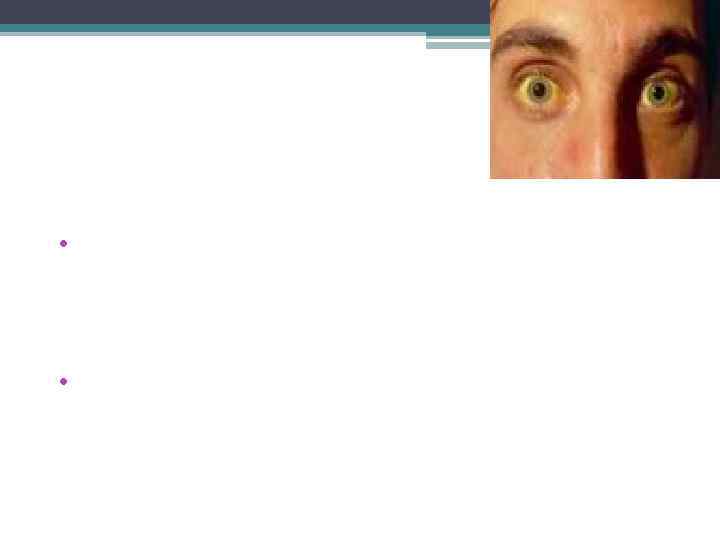 Симптомы По способу выявления симптомы делят на • субъективные ощущения больного (боль, тошнота и