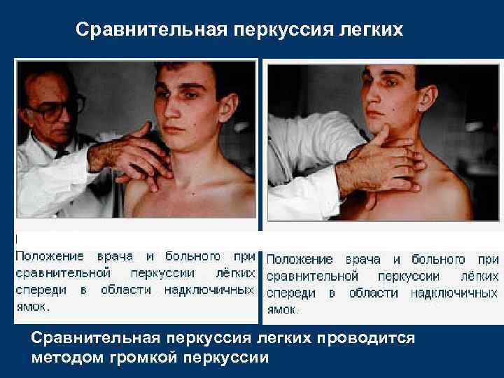 Сравнительная перкуссия легких проводится методом громкой перкуссии 