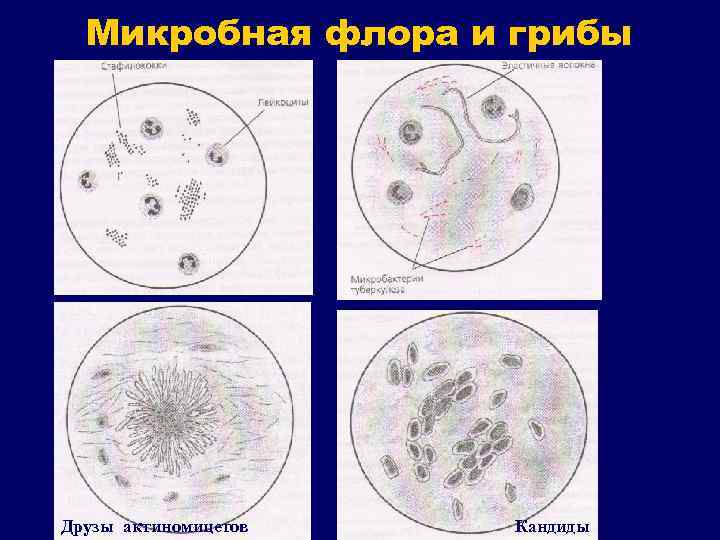 Микробная флора и грибы Друзы актиномицетов Кандиды 