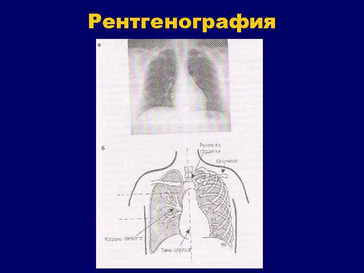 Рентгенография 