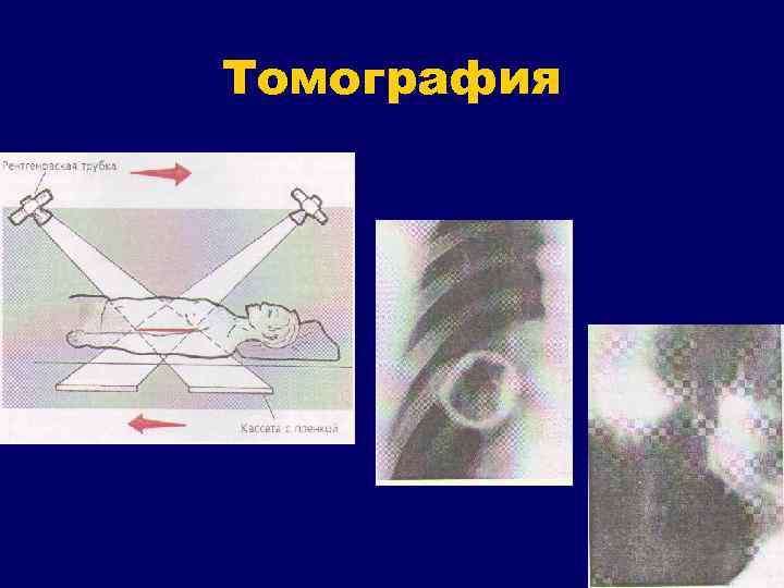 Томография 