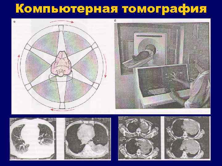 Компьютерная томография 