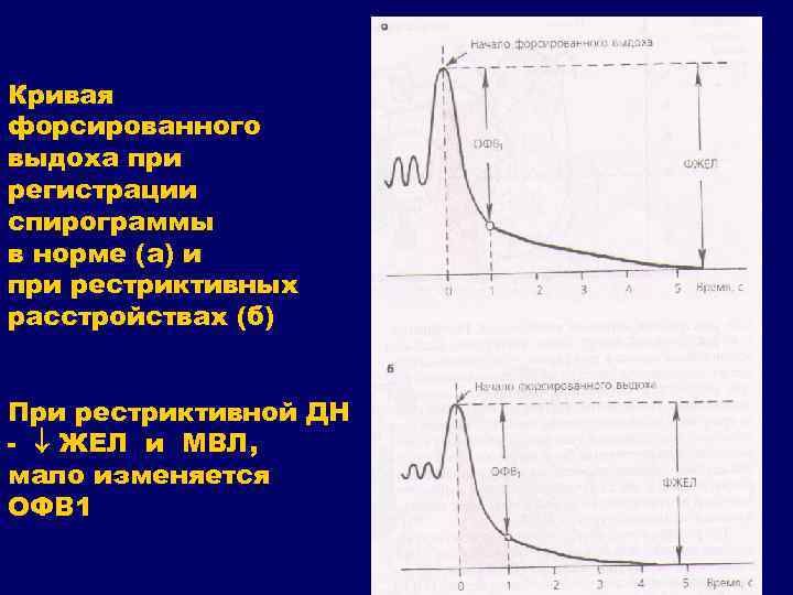 Кривая форсированного выдоха при регистрации спирограммы в норме (а) и при рестриктивных расстройствах (б)