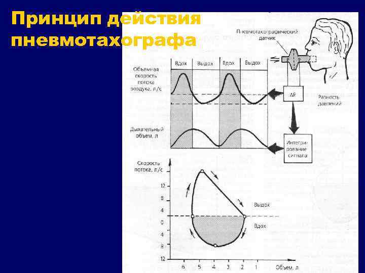 Принцип действия пневмотахографа 
