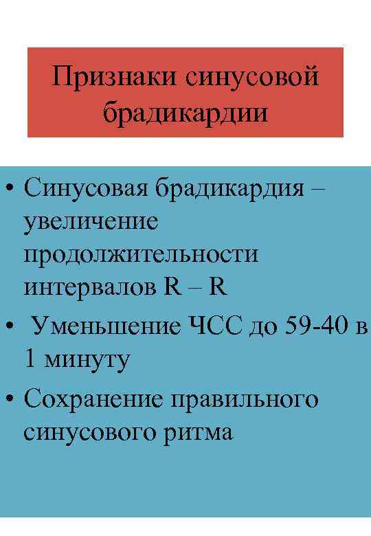 Признаки синусовой брадикардии • Синусовая брадикардия – увеличение продолжительности интервалов R – R •