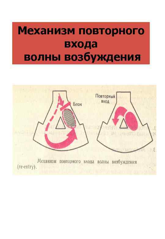 Механизм повторного входа волны возбуждения 