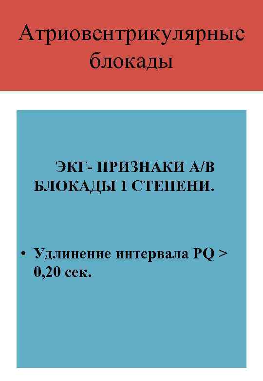 Атриовентрикулярные блокады ЭКГ- ПРИЗНАКИ А/В БЛОКАДЫ 1 СТЕПЕНИ. • Удлинение интервала РQ > 0,