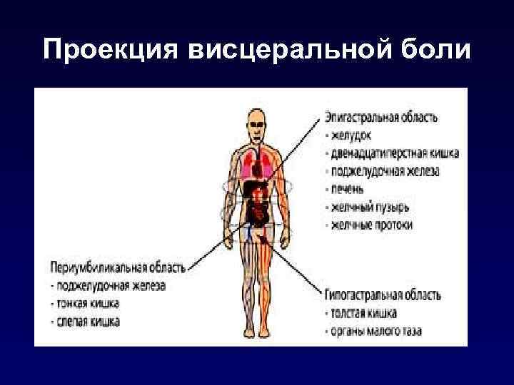 Проекция висцеральной боли 