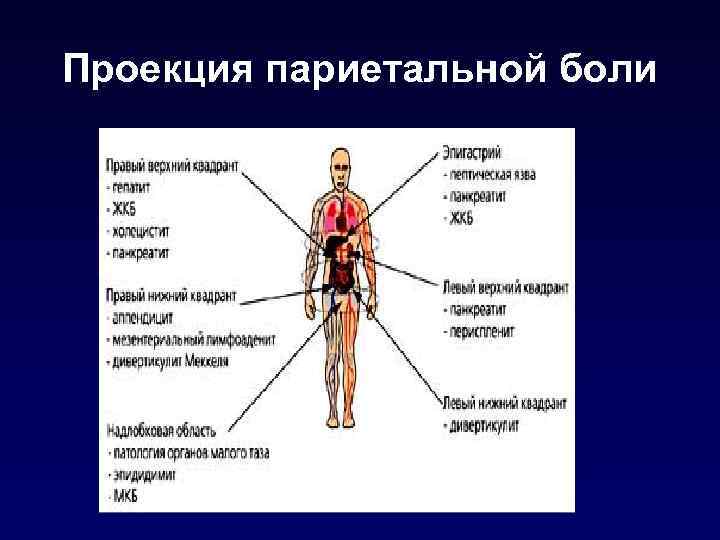 Проекция париетальной боли 