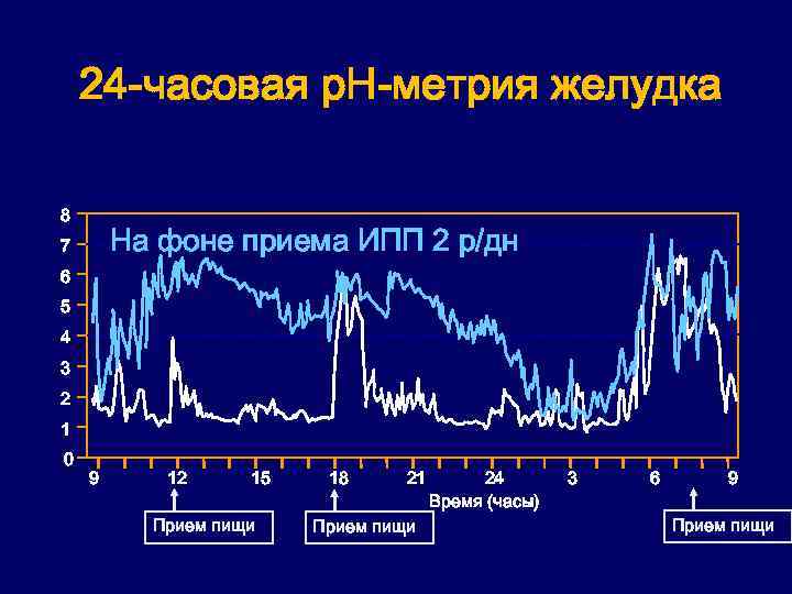 Что такое hp метрия