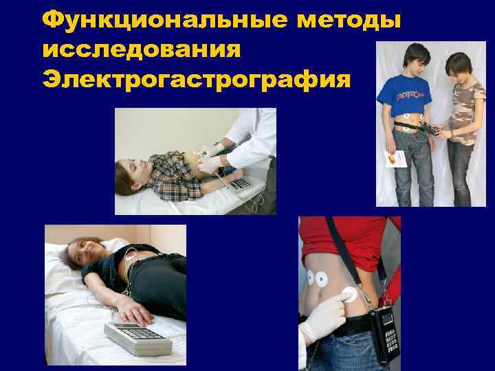 Функциональные методы исследования Электрогастрография 