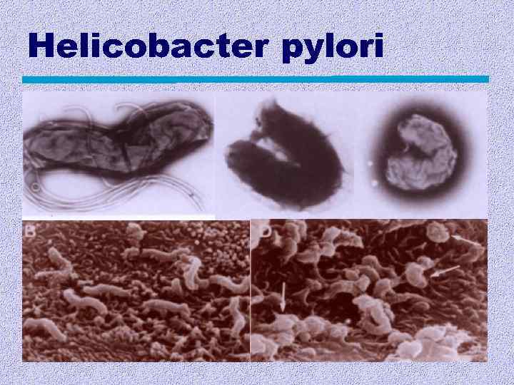 Нelicobacter pylori 